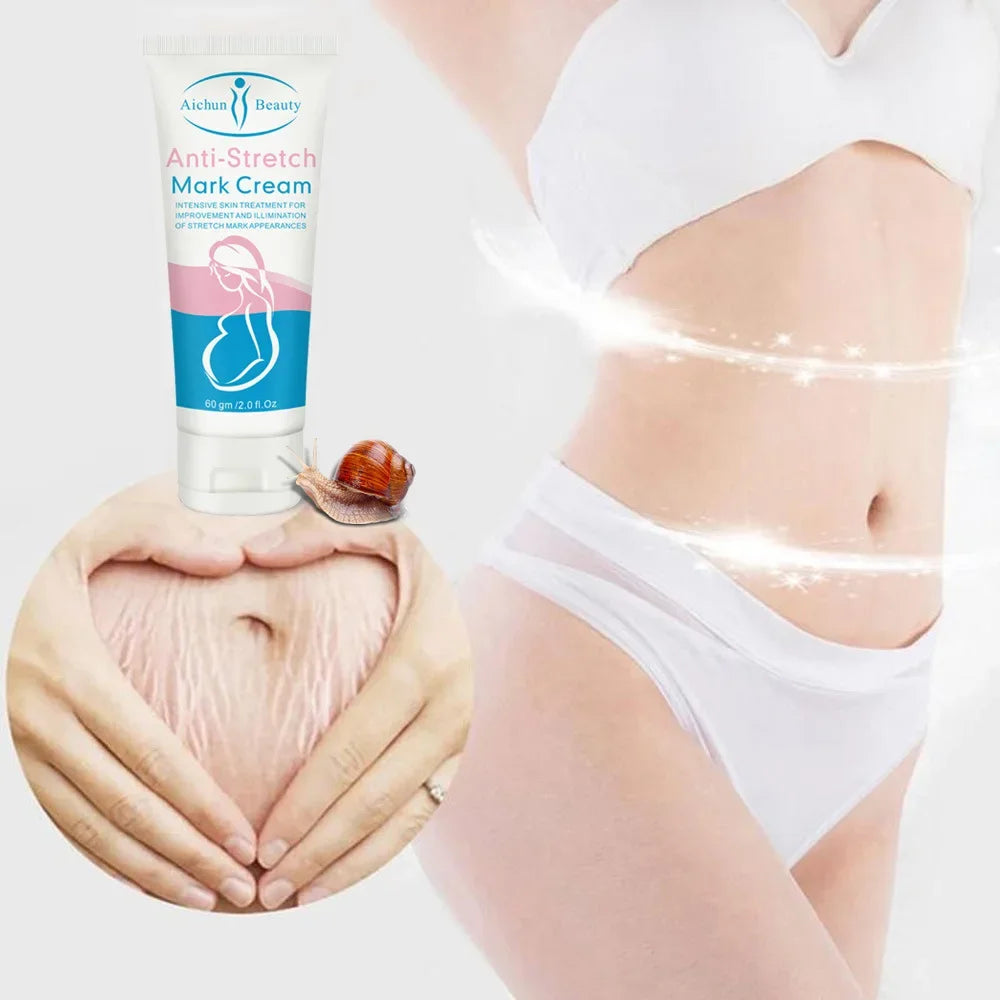 Snail Cream Removes Stretch Marks from Postpartum Obesity-  Firming Body Cream